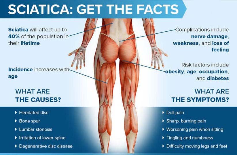 can-flat-shoes-cause-sciatica-symptoms-and-treatment