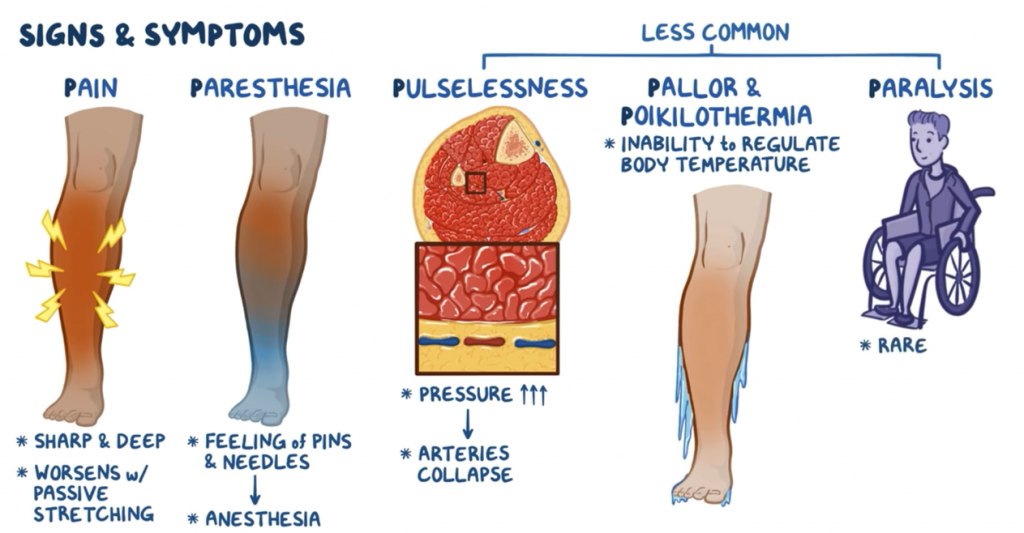 Can You Run With Compartment Syndrome? [What Is It And How To Fix It]