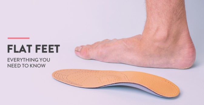 What Are Flat Feet