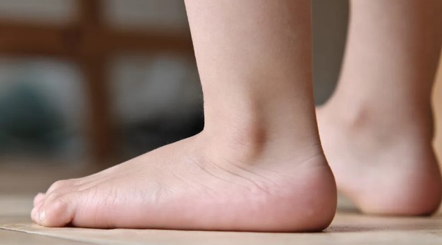 Why Do People Get Flat Feet